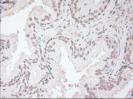 m00045 2 anti vegfa mouse monoclonal antibody clone id oti2f7 ihc testing 7