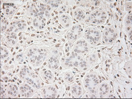 m00045 2 anti vegfa mouse monoclonal antibody clone id oti2f7 ihc testing 8