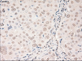 m00045 2 anti vegfa mouse monoclonal antibody clone id oti2f7 ihc testing 9