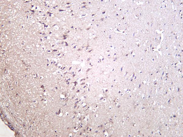 m00045 8 vegfa primary antibodies ihc testing 1