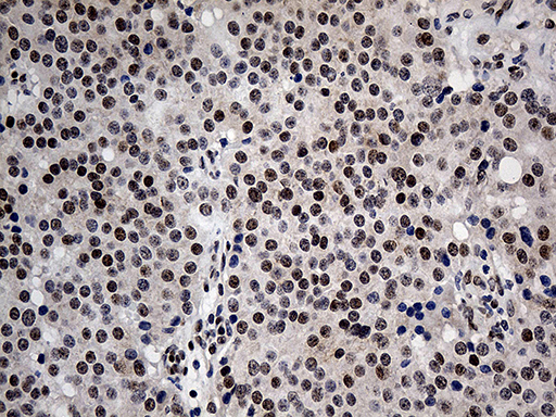 m00047 anti mecp2 mouse monoclonal antibody clone id oti2f1 ihc testing 2