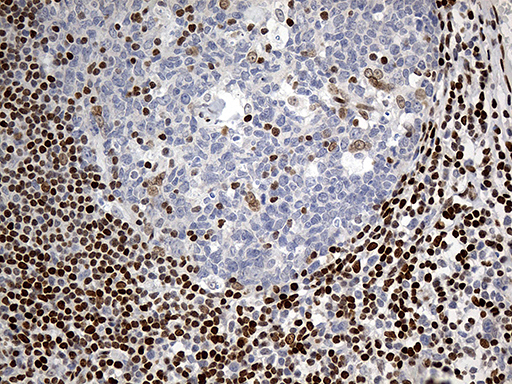 m00047 anti mecp2 mouse monoclonal antibody clone id oti2f1 ihc testing 3