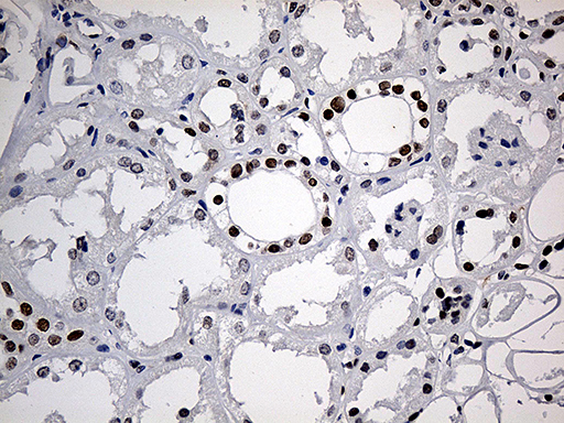 m00047 anti mecp2 mouse monoclonal antibody clone id oti2f1 ihc testing 4