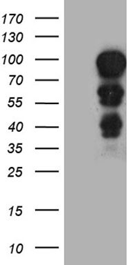 m00047 anti mecp2 mouse monoclonal antibody clone id oti2f1 wb testing 1