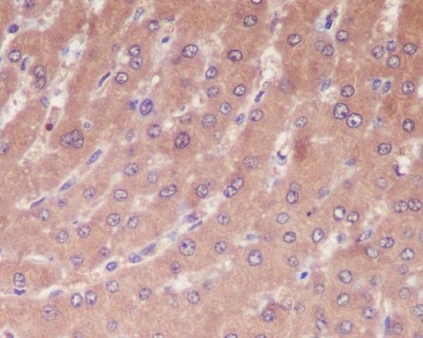 Immunohistochemical analysis of paraffin-embedded human liver, using Caspase-1 Antibody
