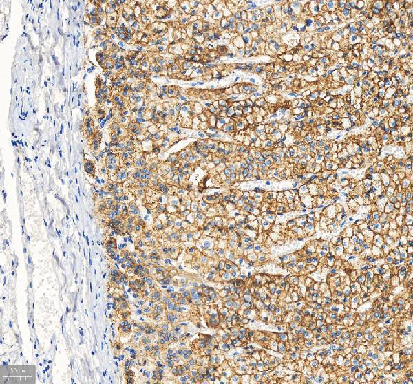 m00049 abcb1 primary antibodies ihc testing 4