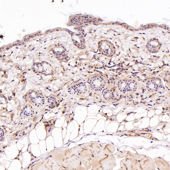 m00049 ihc10
