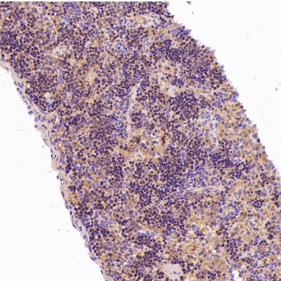 m00049 ihc7