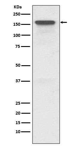 Western blot analysis of P Glycoprotein expression in HeLa cell lysate
