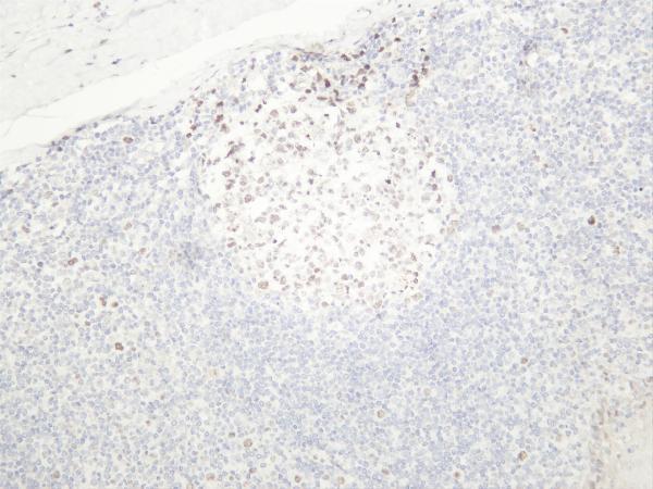 Humantonsil was stained with anti-EZH2 rabbit antibody