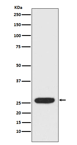Western blot analysis of StAR expression in SK-BR-3 cell lysate