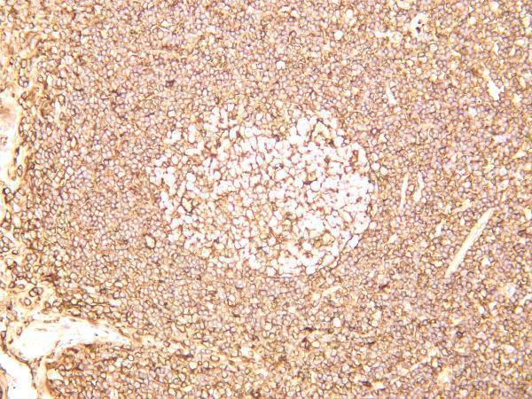 Human tonsil was stained with anti-CD44 rabbit antibody