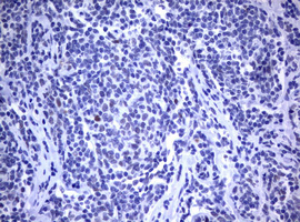 m00054 1 anti mdm2 mouse monoclonal antibody clone id oti1e6 ihc testing 4
