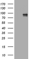 HEK293T cells were transfected with the pCMV6-ENTRY control (Left lane) or pCMV6-ENTRY MDM2 (Right lane) cDNA for 48 hrs and lysed