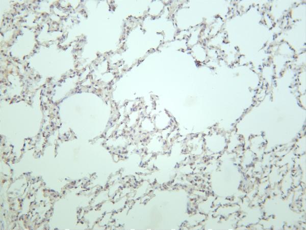 Rat lung was stained with anti-MDM2 rabbit antibody