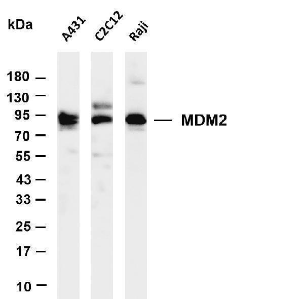 Various whole cell lysates were separated by 4-20% SDS-PAGE, and the membrane was blotted with anti-MDM2 antibody