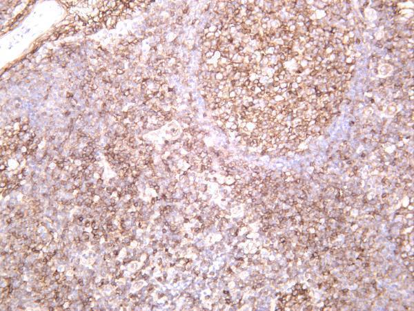 Human tonsil was stained with anti-Fas rabbit antibody