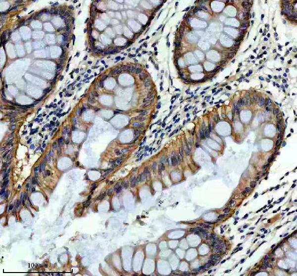 m00055 fas primary antibodies ihc testing 2