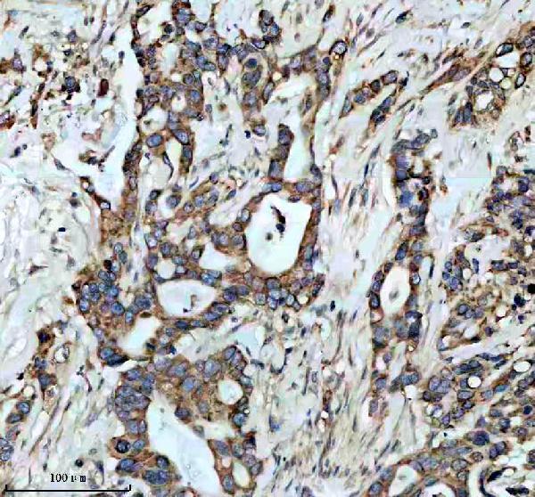 IHC analysis of FAS using anti-FAS antibody (M00055)
