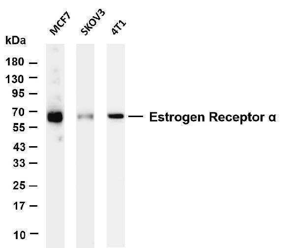 Various whole cell lysates were separated by 4-20% SDS-PAGE, and the membrane was blotted with anti- Estrogen Receptor α antibody