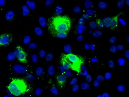 m00058 1 anti sonic hedgehog shh mouse monoclonal antibody clone id oti10h6 if testing 3