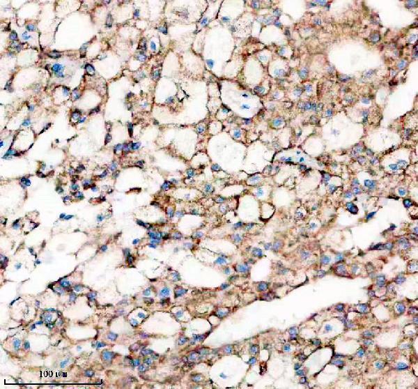m00058 shh primary antibodies ihc testing 1