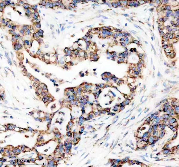 m00058 shh primary antibodies ihc testing 2