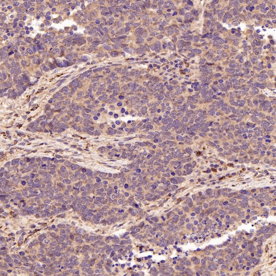 m00059 ihc7