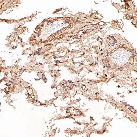 m00059 ihc8