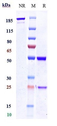 Anti-Polyubiquitin Reference Antibody (Genentech patent anti-Polyubiquitin) on SDS-PAGE under reducing (R) condition