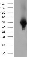 HEK293T cells were transfected with the pCMV6-ENTRY control (Left lane) or pCMV6-ENTRY HP (Right lane) cDNA for 48 hrs and lysed