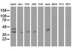 m00062 1 anti haptoglobin hp mouse monoclonal antibody clone id oti4h5 wb testing 2