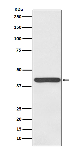 Western blot analysis of Haptoglobin expression in human plasma lysate