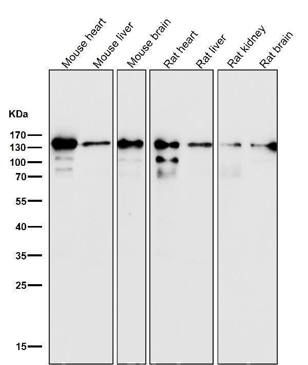 All lanes use the Antibody at 1:1W dilution for 1 hour at room temperature
