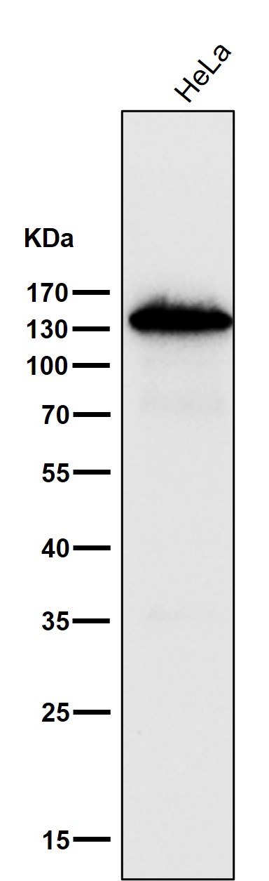All lanes use the Antibody at 1:1W dilution for 1 hour at room temperature