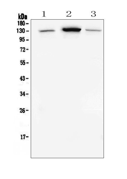  Western blot analysis of E Cadherin using anti-E Cadherin antibody (M00063-2)