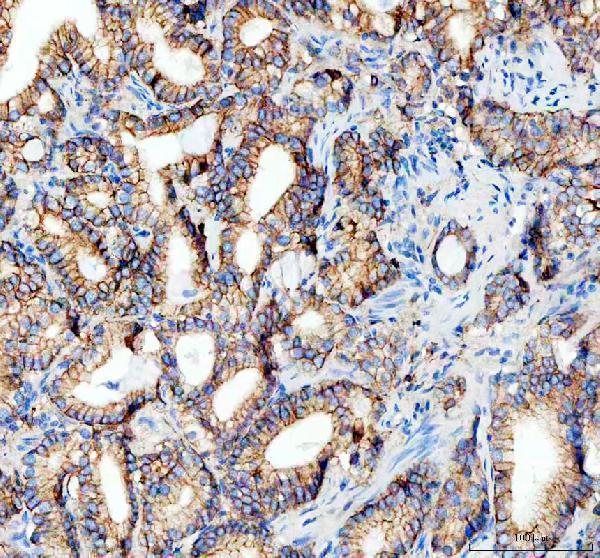 m00063 2 e cadherin primary antibodies ihc testing 2