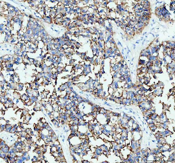 m00063 2 e cadherin primary antibodies ihc testing 3