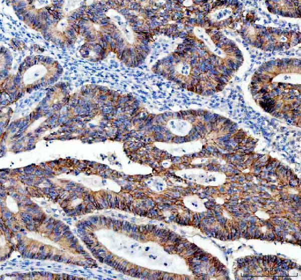 m00063 2 e cadherin primary antibodies ihc testing 5_1