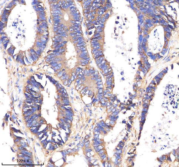  IHC analysis of E Cadherin using anti-E Cadherin antibody (M00063-4)