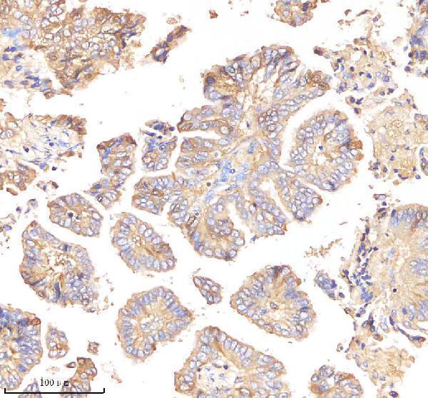  IHC analysis of E Cadherin using anti-E Cadherin antibody (M00063-4)