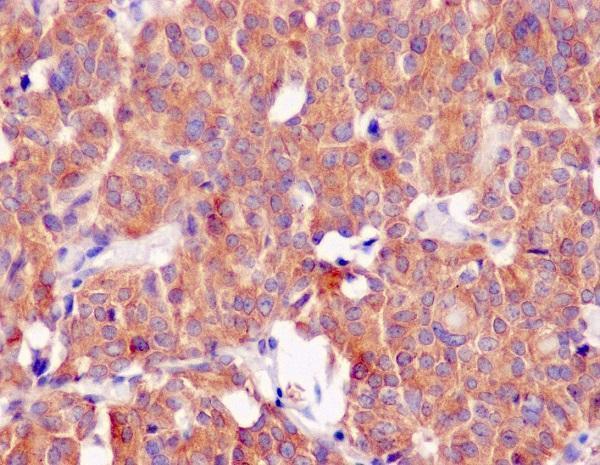 m00064 ihc