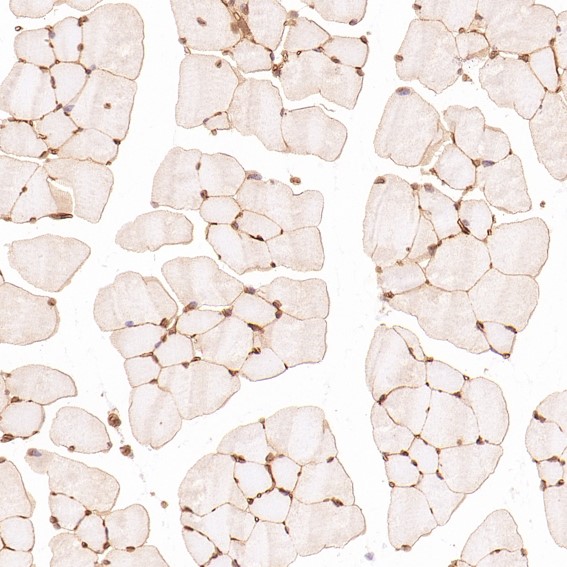 m00066 1 ihc11