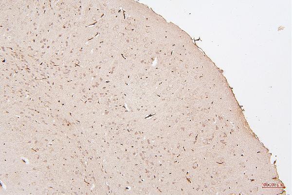 m00066 2 hmgb1 primary antibodies ihc testing 11