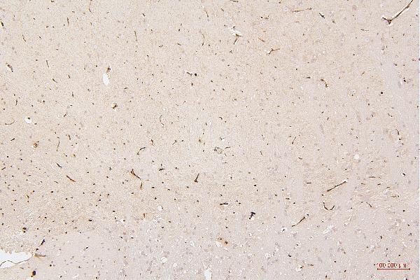 m00066 2 hmgb1 primary antibodies ihc testing 12