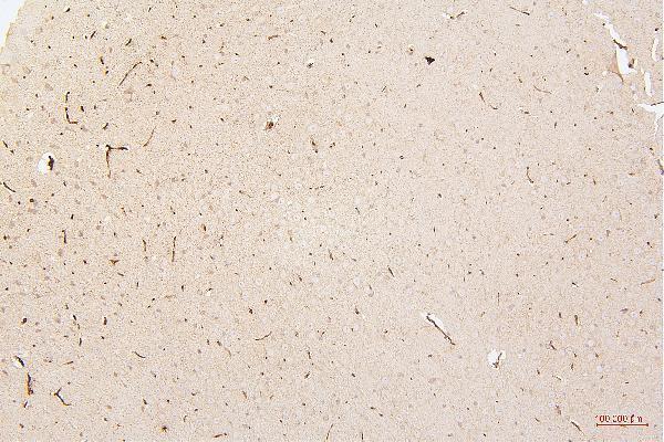 m00066 2 hmgb1 primary antibodies ihc testing 13