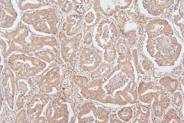 m00066 2 hmgb1 primary antibodies ihc testing 14