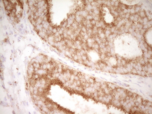 m00068 1 anti cd40 mouse monoclonal antibody clone id oti8b8 ihc testing 11