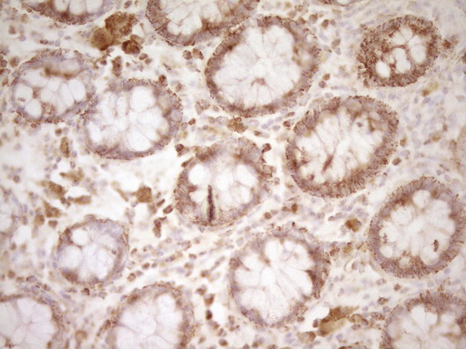 m00068 1 anti cd40 mouse monoclonal antibody clone id oti8b8 ihc testing 12