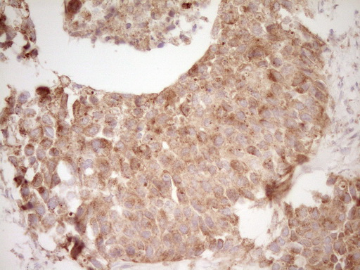 m00068 1 anti cd40 mouse monoclonal antibody clone id oti8b8 ihc testing 15